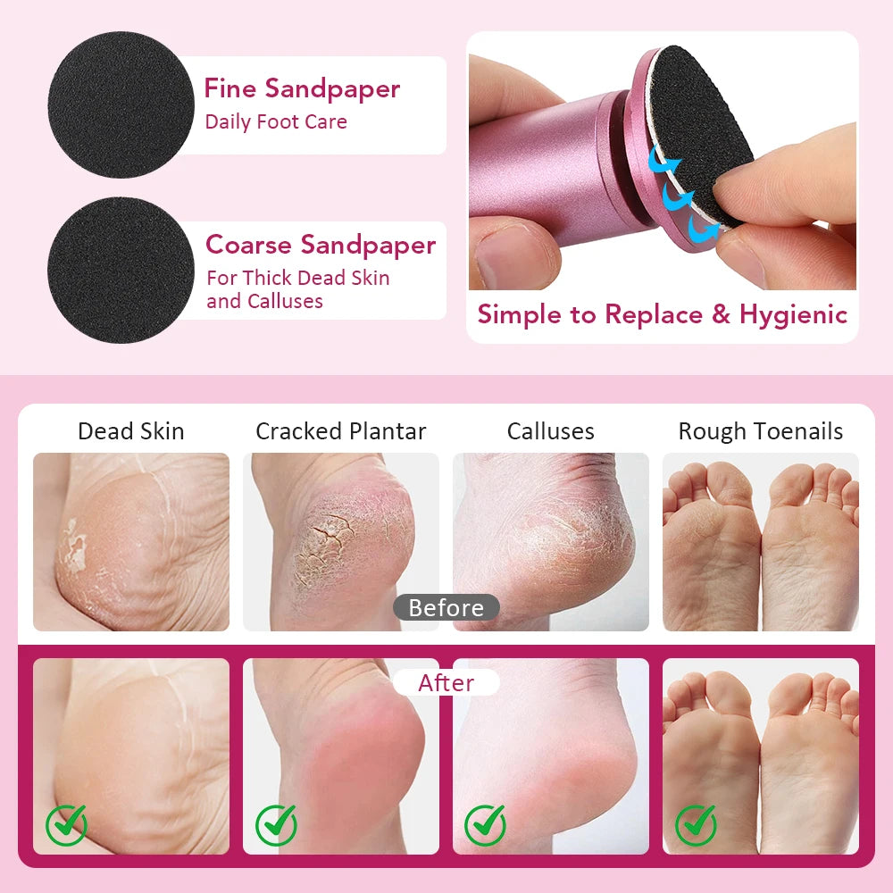 Electric Foot Callus Remover