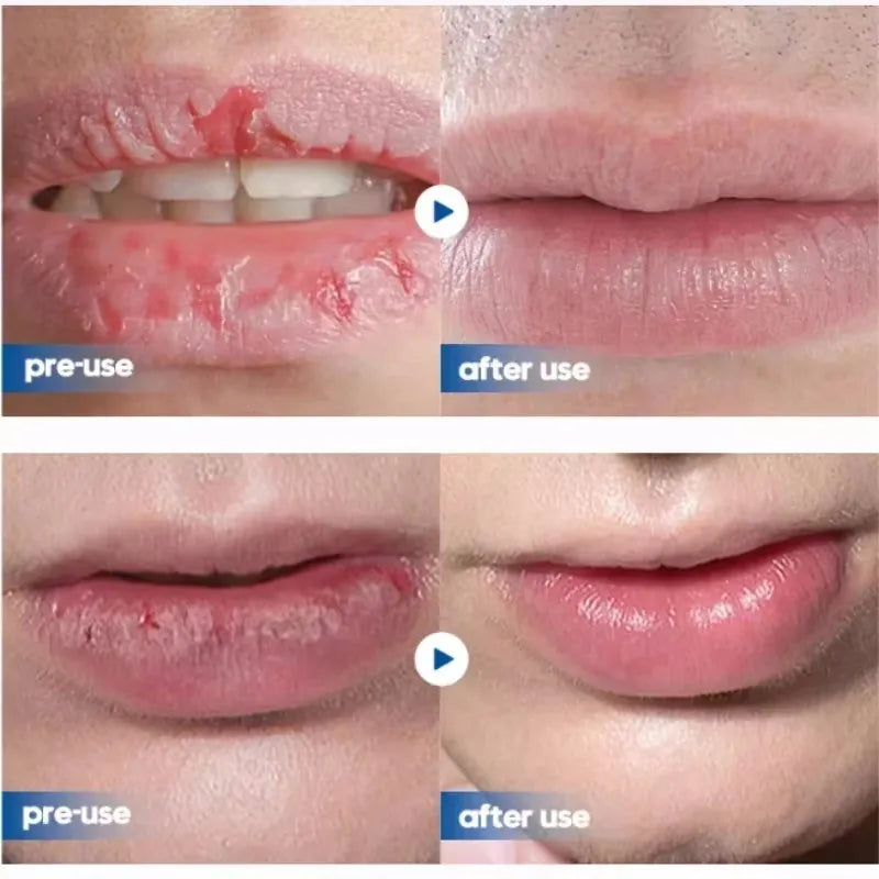 Men Lip Balm
