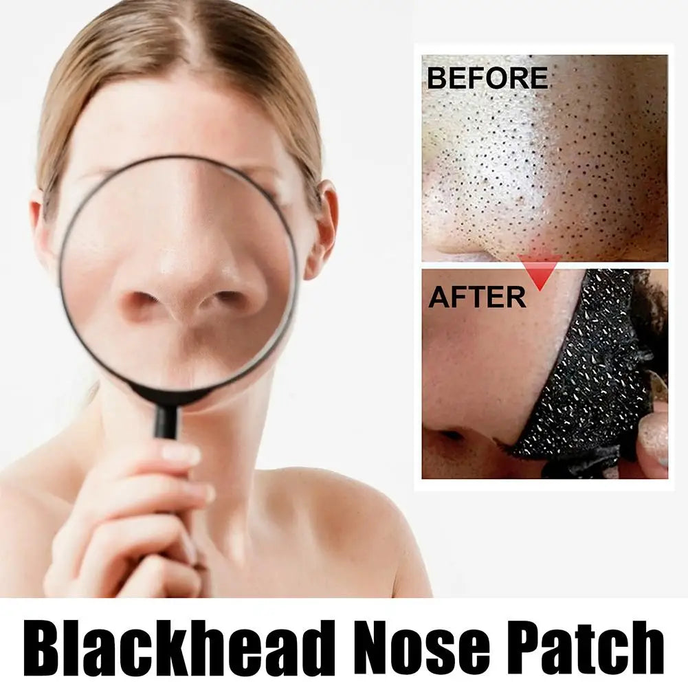 Blackhead Remover Nose Strips
