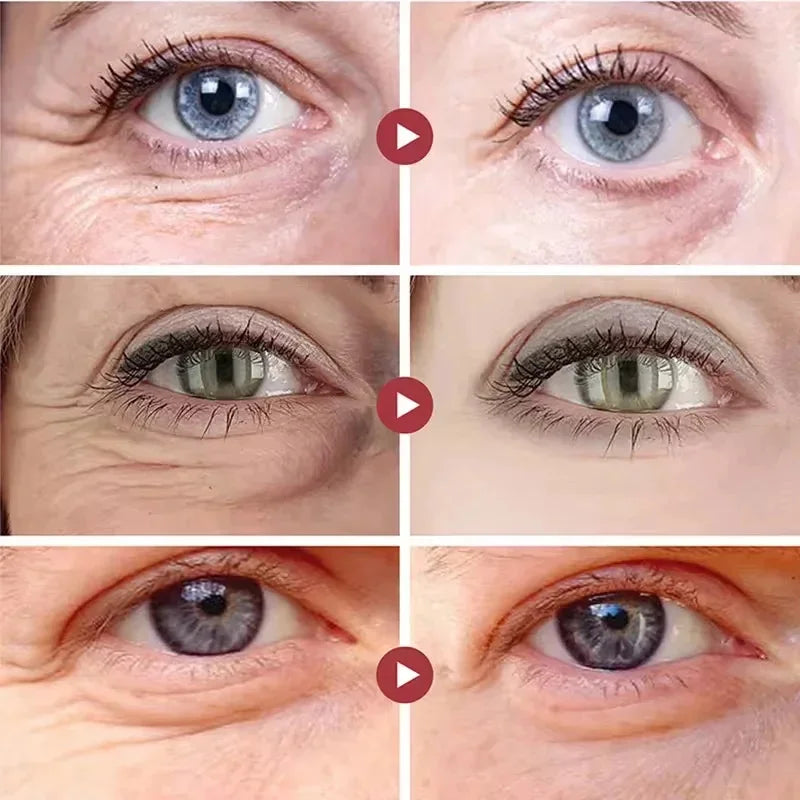 Anti-Wrinkle & Dark Circle Eye Mask