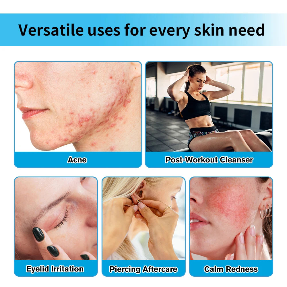 Hypochlorous Acid Facial Spray