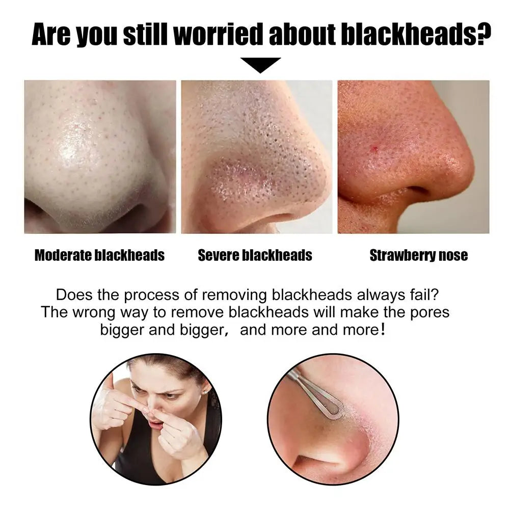 Blackhead Remover Nose Strips