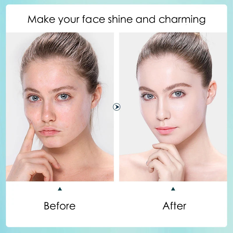 Hyaluronic Acid Moisturizing Face Mask