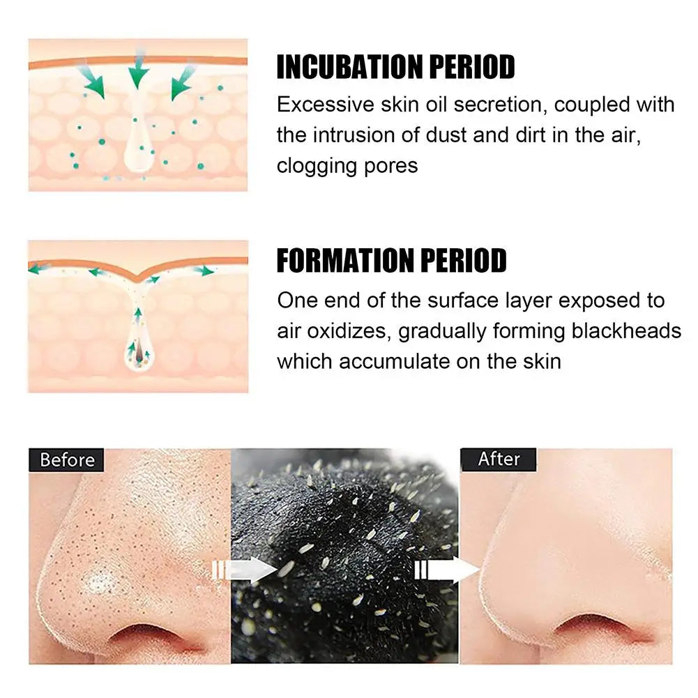 Blackhead Remover Nose Strips