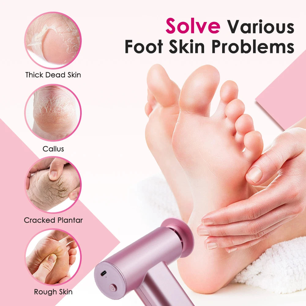 Electric Foot Callus Remover